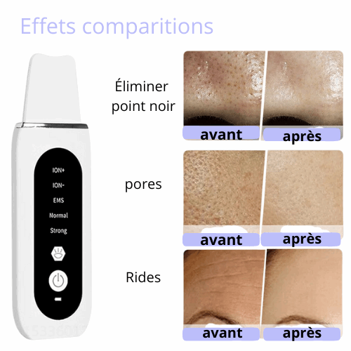 nettoyage en profondeur du visage