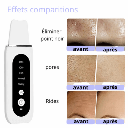 nettoyage en profondeur du visage