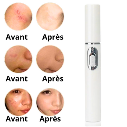 Nautylia RejuvaLight™